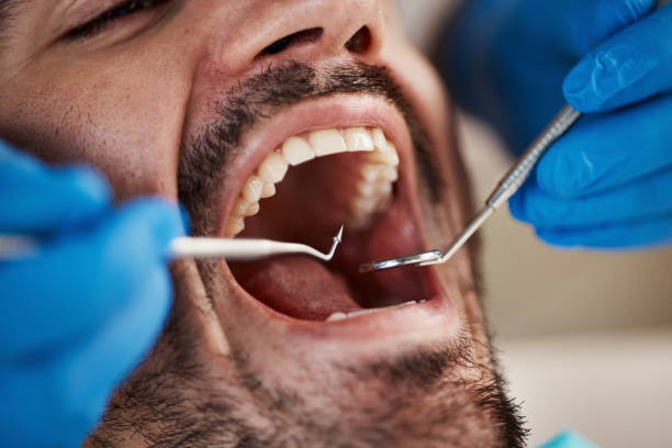 Best Knocked-Out Tooth Emergency  in Swissvale, PA